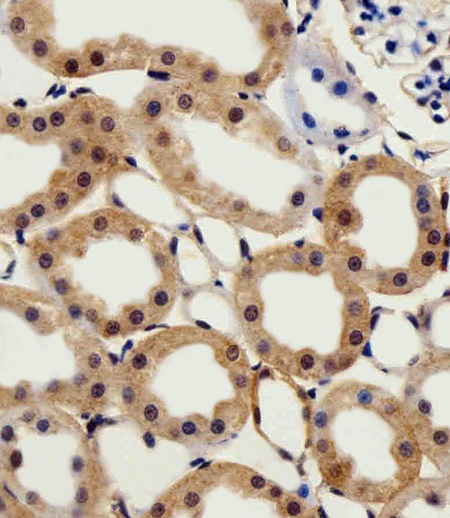 IHC-P - CSNK2A1 Antibody (Center) AW5043-U100
